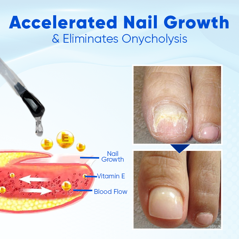 Liascy™ OnyxoGuard Nail Growth and Repair Serum