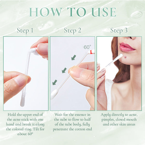 NEVU Acne Spot Applicator